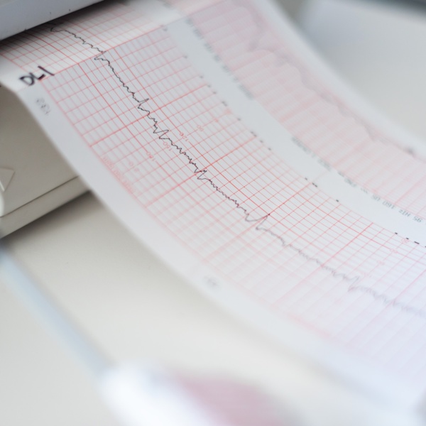 PAPEL ECG 21 CMS X 20MTS MARCA HAIM - Imagen 4