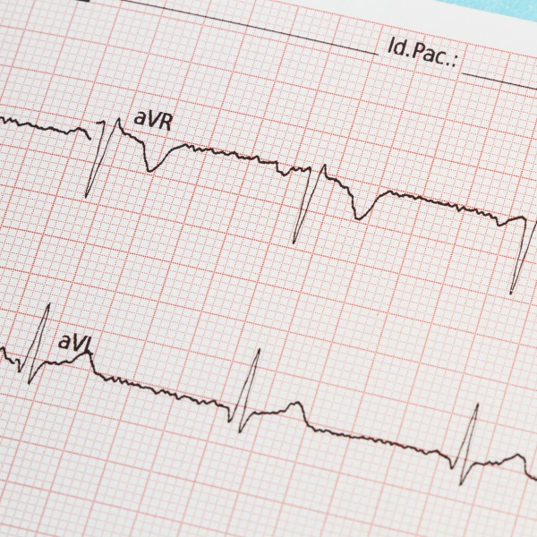 PAPEL  ECG  CARDIOLINE - Imagen 5