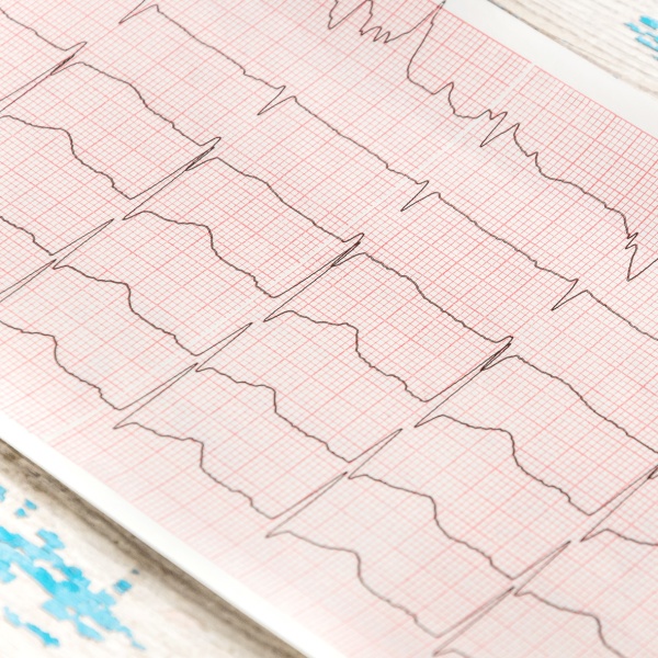 PAPEL  ECG  CARDIOLINE - Imagen 6