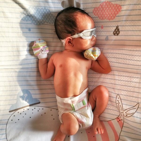 ANTIFAZ NEONATAL - Imagen 4